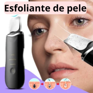 Limpador Esfoliador Facial Ultrassônico – Cravos, Acne e Poros Limpinhos em Casa